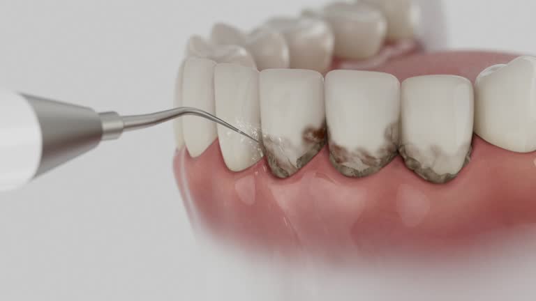 Reliable Dental contractor in Brunswick, OH by Dentist Open Now